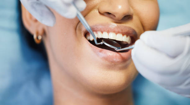 Best Emergency Dentist for Lost Fillings or Crowns in Mancelona, MI